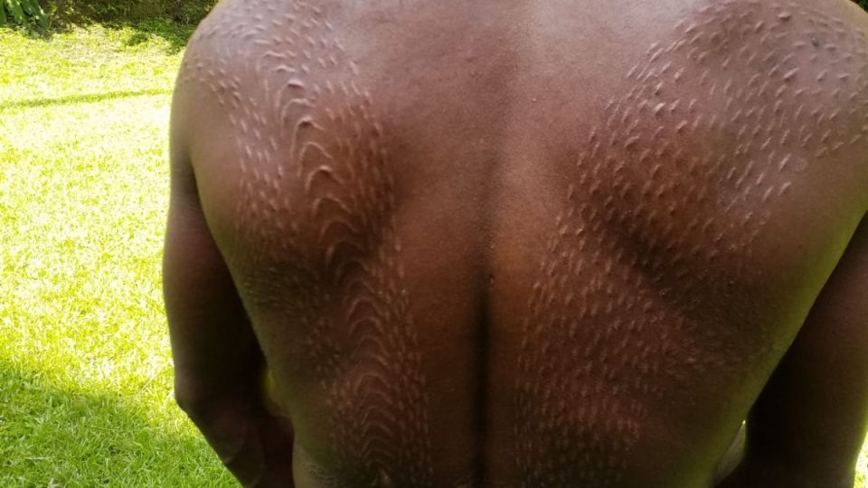 Rücken eines Krokodil-Mannes mit Narbenmuster